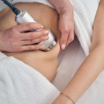 Sono Bello (A.K.A Laser Liposuction) Review